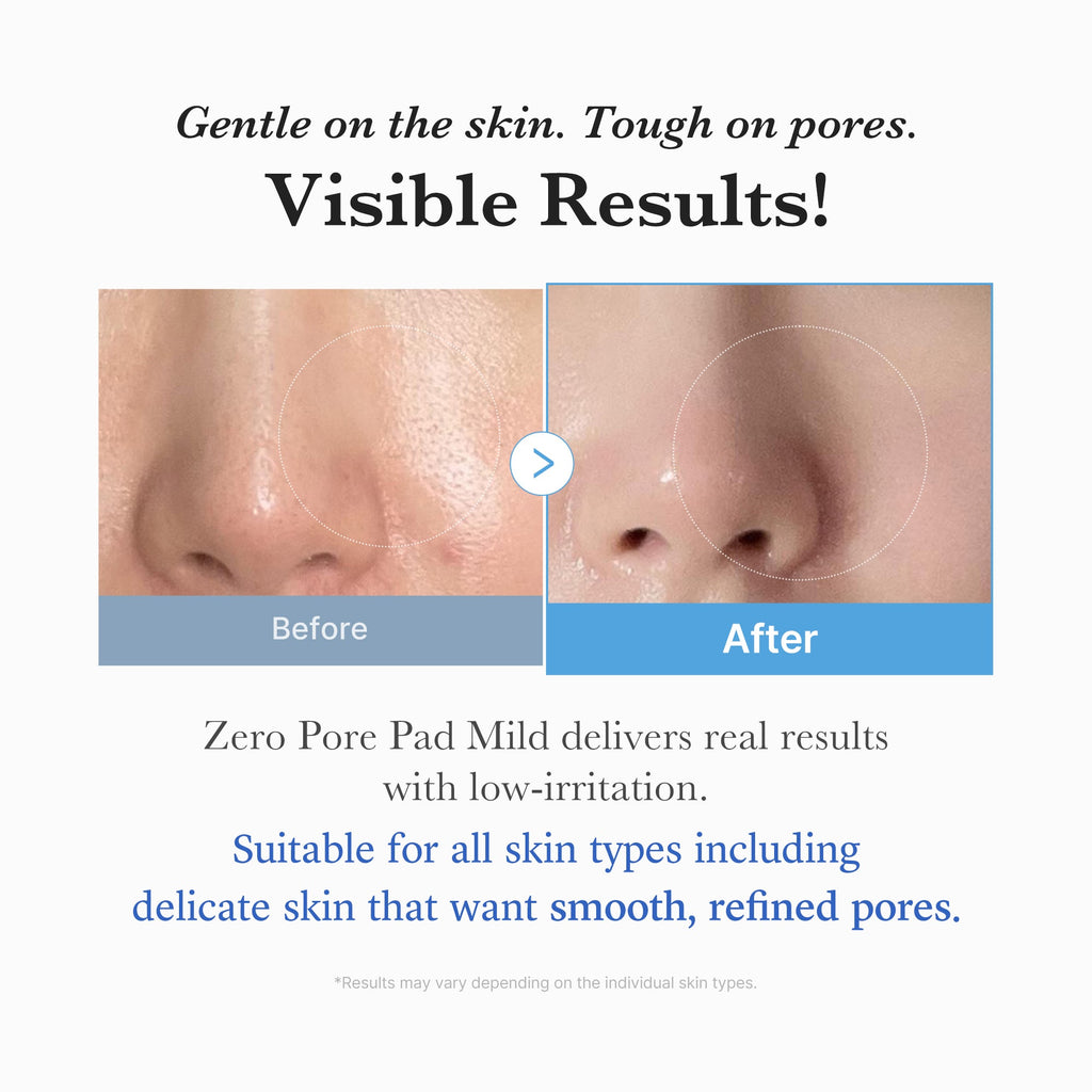 Zero Pore Madecassoside Pads (Mild) - medicube.us