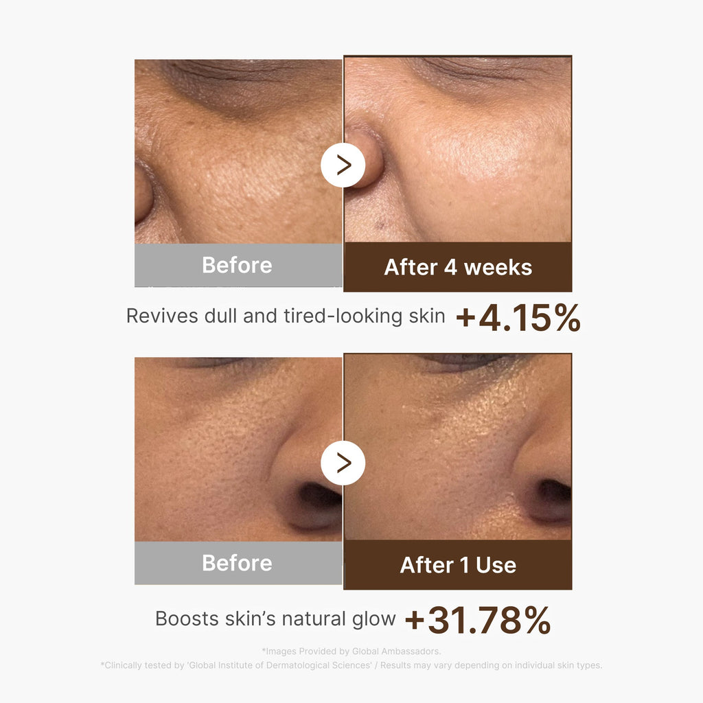 Deep Vitamin C Capsule Serum - medicube.us