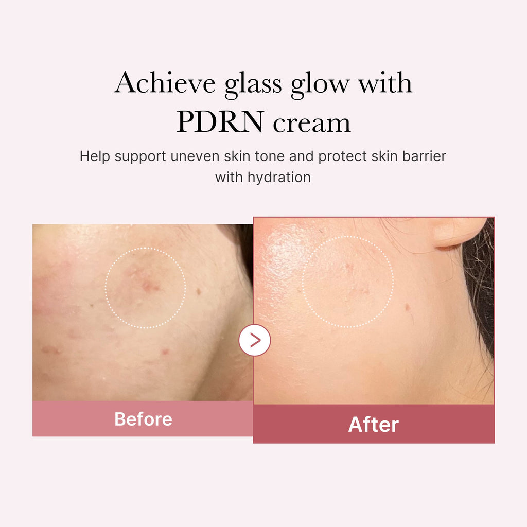 [GIFT] PDRN Pink Peptide Cream - medicube.us